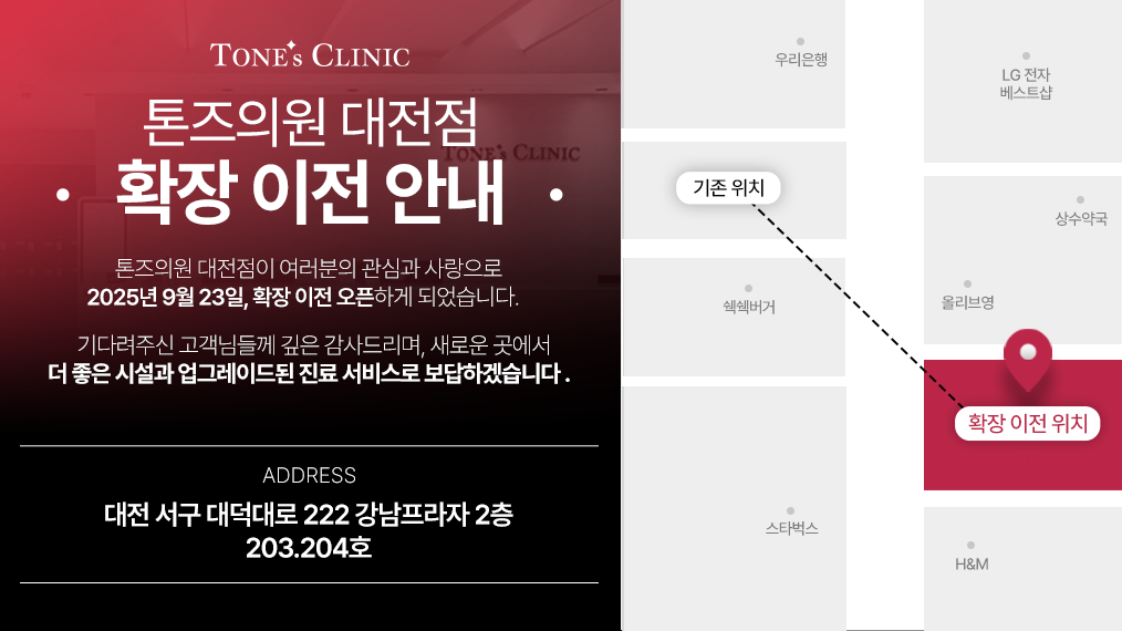 팝업
